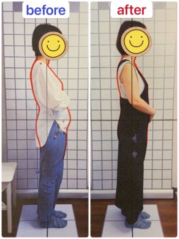 腰痛改善　４０代　女性