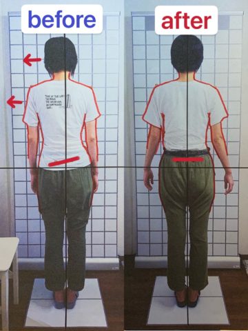 首の痛み改善　４０代　女性