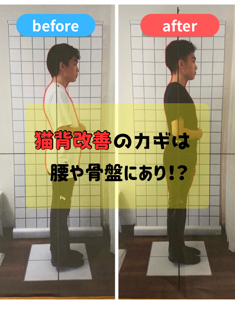 猫背改善のカギは、腰や骨盤にあり！？